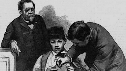 Joseph Meister, 1885. On inocula, sous un pli fait à la peau de l’hypocondre droit du petit Meister, une demi-seringue de Pravaz d’une moelle d’un lapin mort rabique 