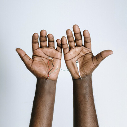 Par de manos con diversos cables integrados. El primer dispositivo le permite a Esteban sentir el campo magnético terrestre por medio de vibraciones
