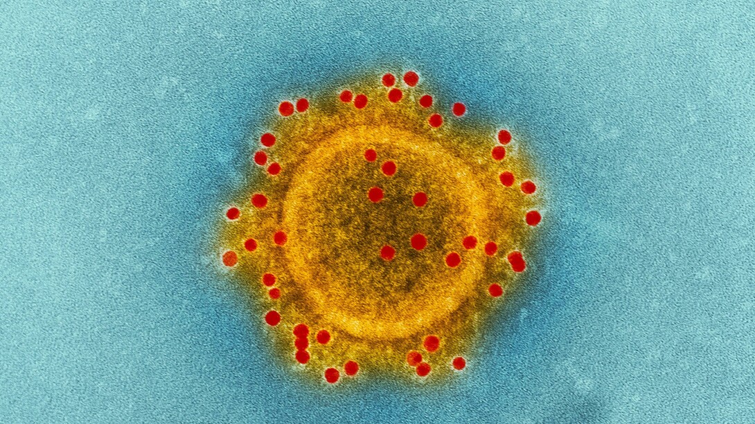 Imagen tomada con un microscopio electrónico de transmisión (TEM) y coloreada digitalmente que resalta la envoltura de partículas de un solo virión del coronavirus del síndrome respiratorio del Medio Oriente (MERS-CoV) 