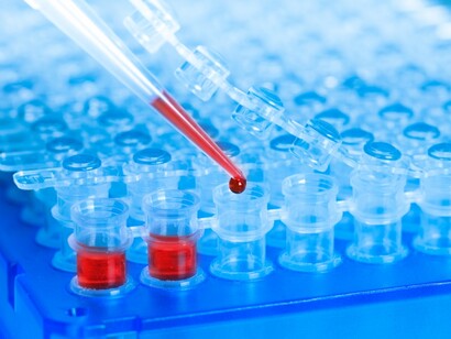 Análise de sangue