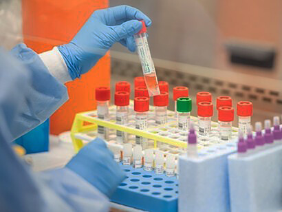 Vaccine candidates are being developed, while others are already in clinical trials