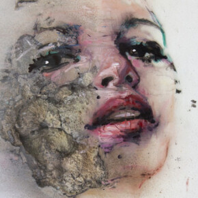 Hedgehog's Skin. Courtesy of Ivy Brown Gallery