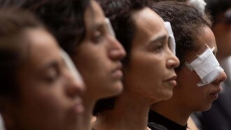 Young protesters show solidarity with those who lost an eye due to the brutal police repression in Chile