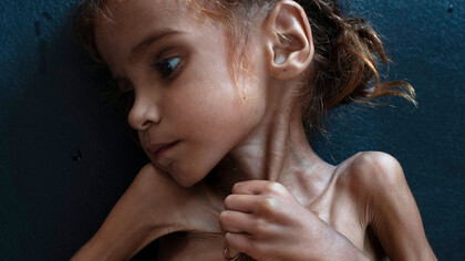 The little Amal Hussain