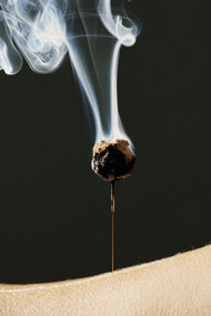 The Origin of Acupuncture & Moxibustion