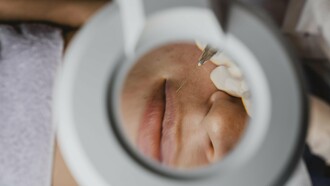 With minimal cost and less recovery than surgery, dermal fillers are a cornerstone of modern, accessible aesthetics