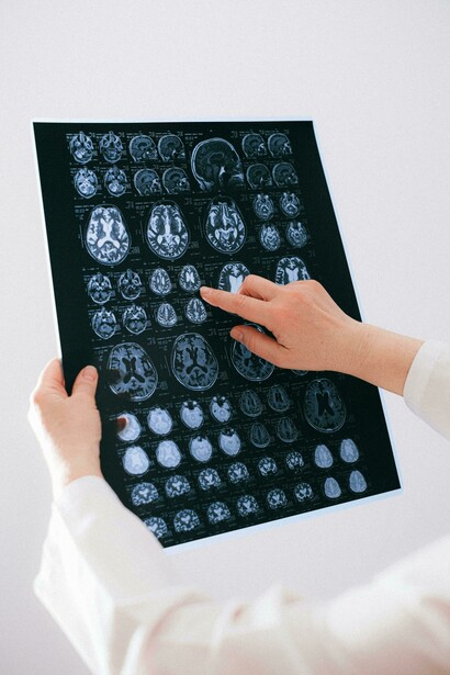 Le lastre di un cervello. Il processo intuitivo è alimentato da una serie di fattori, e le aree del cervello coinvolte sono spesso associate alla memoria, alle emozioni e all'elaborazione rapida delle informazioni