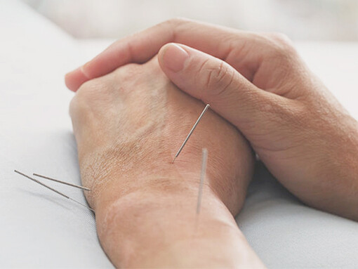 Arthritis affects many people, and can be treated through acupuncture therapy
