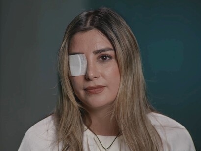 Elahe Tavakolian perse un occhio perché colpita da un proiettile durante la protesta del 2022. Appartiene al movimento 'Donna, vita, libertà'