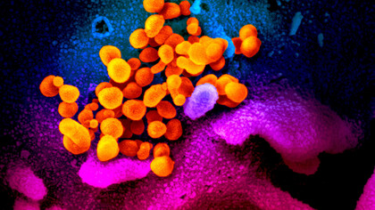 Imagen obtenida con microscopio electrónico (falso color) del virus SARS-CoV-2 (resaltado en color anaranjado)