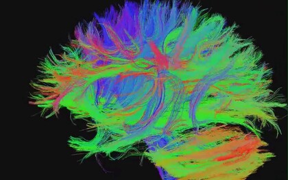 Conectoma: mapa detallado y exhaustivo de todas las conexiones neuronales que existen en un  un cerebro
