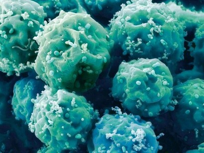 A microscopic view of stem cells, they can be sourced from adipose (fat) tissue in adults and can have anti-inflammatory properties