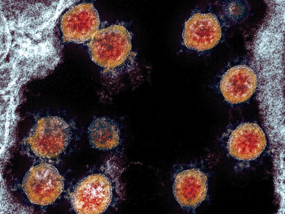El virus SARS-COV-2 bajo el microscopio