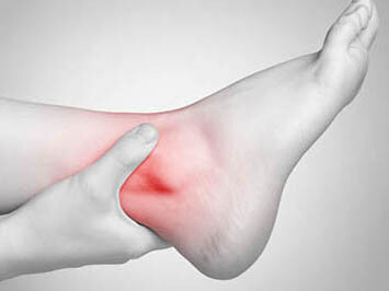 Un trauma alla caviglia