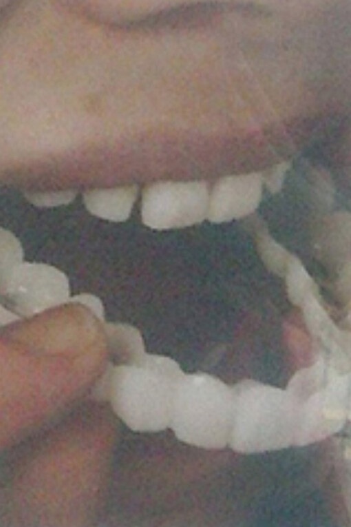 Lai Lon Hin, Denture Number 4, 2014, Archival inkjet print on Hahnemühle paper. Courtesy of artist and Blindspot Gallery
