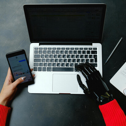 A woman with a prosthetic hand uses a laptop and smartphone, embracing technology in her daily life