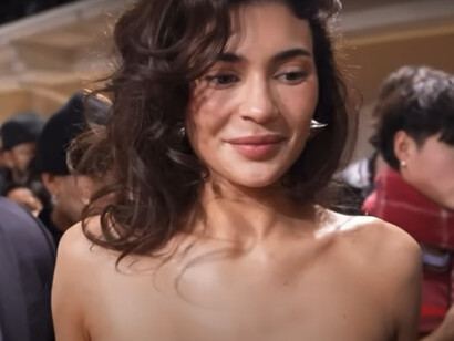 Kylie Jenner recently made headlines with her appearance on the Gaultier red carpet, showcasing noticeably fuller facial features