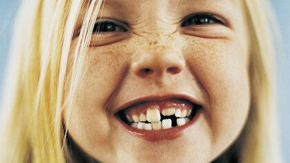 Cosa ci dicono i nostri denti