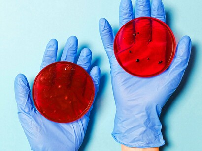 Cultura de bactérias. Algumas mucinas podem interagir com outras moléculas nas superfícies celulares, influenciando o comportamento e a comunicação das células. As quantidades de mucina e as alterações na sua estrutura estão associadas a vários tipos de cancro, incluindo os do trato gastrointestinal e da mama. As mucinas desempenham um papel em condições inflamatórias, como as que afectam as vias respiratórias (asma, bronquite)