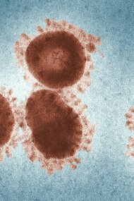 Coronavirus