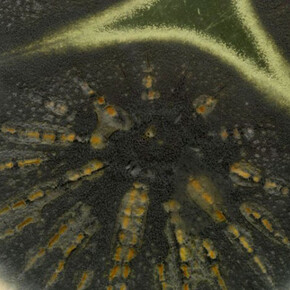 Superbugs. Courtesy of Science Museum