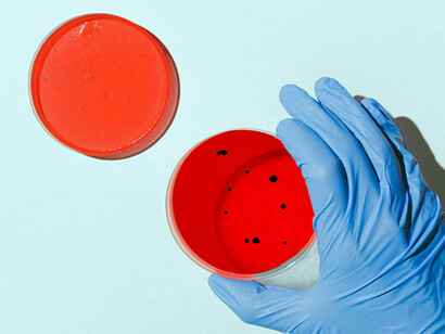 Scientifique avec verre de Petri. Les très petites bactéries se reproduisent à grande vitesse, si bien qu’une colonie bactérienne peut contenir des millions d’individus dans un banal tube à essai 