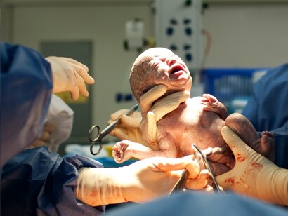 Bebé recién nacido