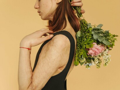 A woman marked by burn scars holding fresh flowers, reflecting the grace found in perseverance