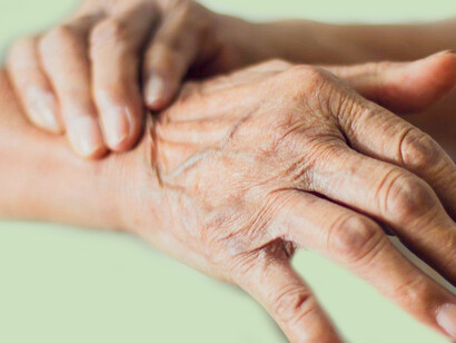 Cuando existen la EP junto con otras manifestaciones, se denomina entonces, parkinsonismo plus o parkinsonismo atípico, y cuando están presentes los síntomas característicos los médicos hablan de parkinsonismo o síndrome parkinsoniano