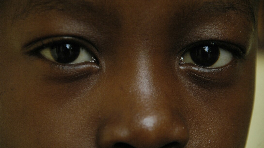 Sudanese refugee