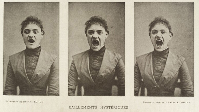 Three photos in a series showing Early animated picture by John Arthur Roebuck Rudge depicting the face of William Friese-G a hysterical woman yawning