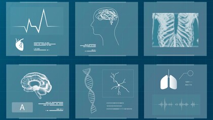 L’intelligenza artificiale si sta diffondendo rapidamente nei sistemi sanitari, ma le prove del suo reale valore clinico restano ancora insufficienti