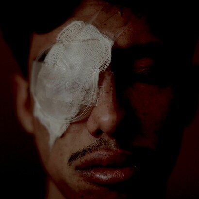 Mutilados por las fuerzas del «orden»