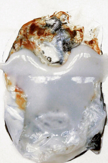 Takesada Matsutani. Courtesy of Hauser & Wirth