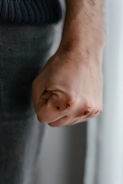 A detailed close-up of a person's fist, showing a fresh wound across the knuckles