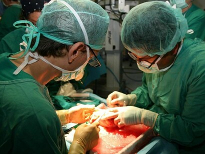 Operación de trasplante de médula ósea