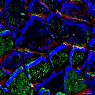 Wally Gilbert, Shadows (detail), 2024. Courtesy of Viridian Artists