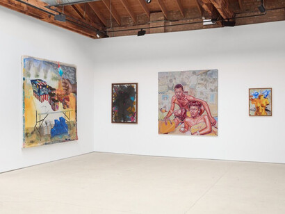 Hank Willis Thomas, Life imitates art, exhibition view. Courtesy of Anthony Gallery