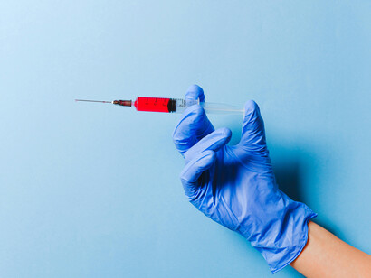 A futuro, la integración con inteligencia artificial y big data podría convertir a la biopsia líquida en una herramienta central de la medicina personalizada