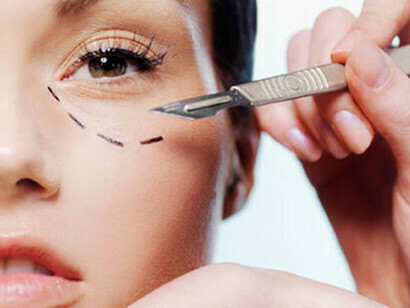 Chirurgie esthétique
