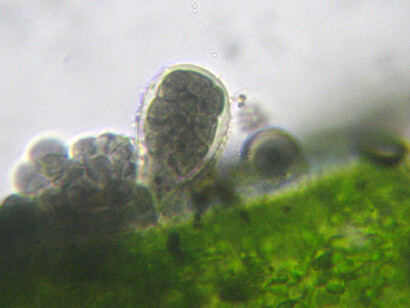 Chytridium sp., presente nelle Saline di Cervia (Ra)