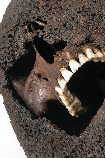 Medieval Massacre. Courtesy of Historiska museet