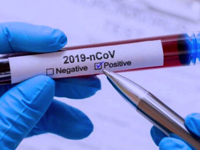 Ahora sabemos que el comportamiento humano y los cuidados contra la infección son muy importantes, incluso aunque estuviéramos vacunados