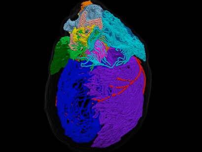 Mapa de el sistema neuronal del corazón