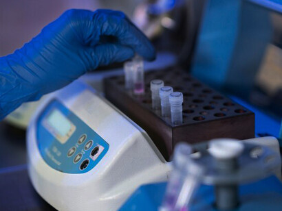 A laboratory technician meticulously organizes pipette tips in a blue container for efficient genetic testing procedures