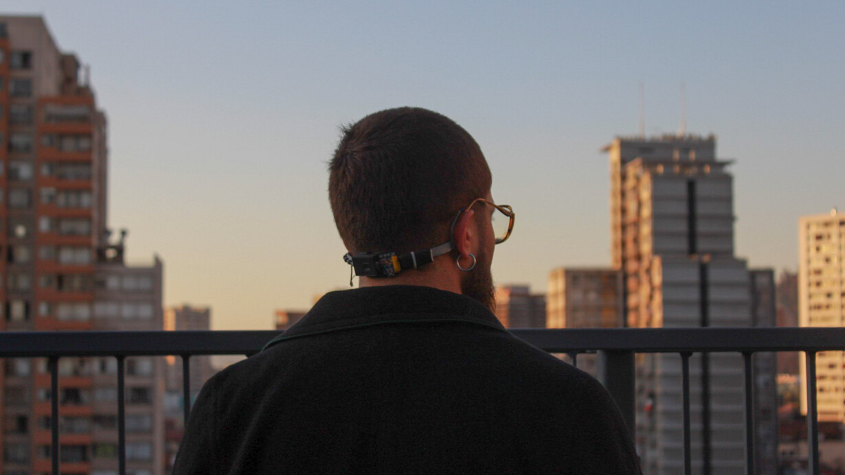 El primer artista cyborg chileno, Esteban Celis, mirando hacia los edificios de Santiago de Chile. Fotografía de Igna Solis Carrillo