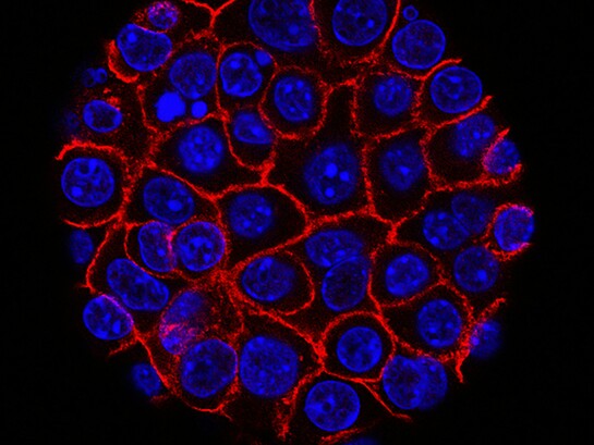 New hope for pancreatic cancer: researchers identify CAPG, a promising biomarker that could transform early detection and future treatment strategies