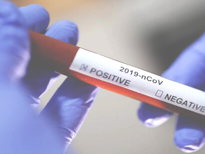 While the pandemic can be contained through vaccination, many long term problems  cannot be fixed without radical changes 
