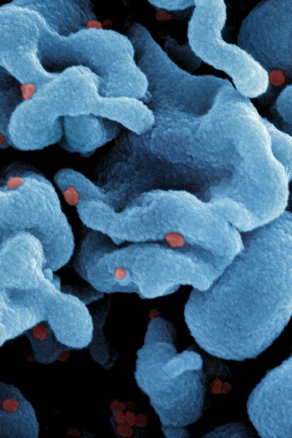 Célula infectada con partículas de la cepa omicrón virus SARS-CoV-2