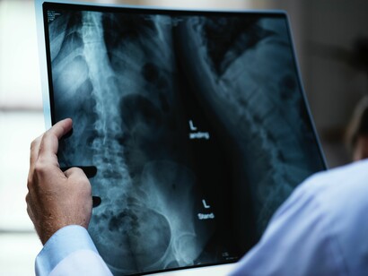 Evitare l'abuso di radiografie